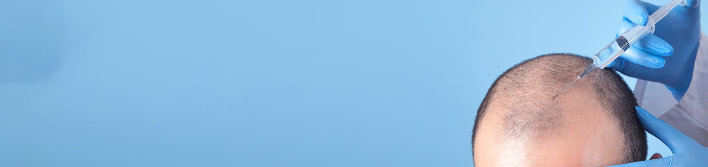 PRP Hair Treatment Pre and Post Care Instructions: Your Complete Guide